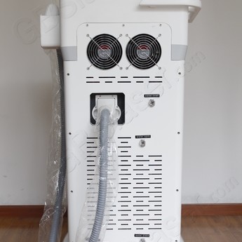 laser hair removal systems