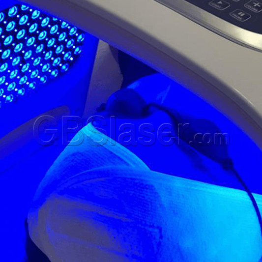 quantum light LED machine blue light therapy for acne scar